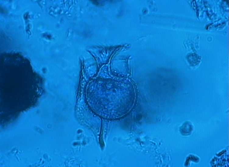 Dictyocha speculum
